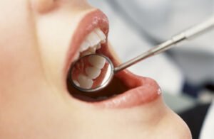 Лечение каналов зуба в клинике Айсберг